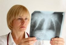 «Хворі ходять кругом. Їх же не прив’яжуть…»