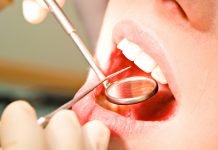 У 7 павлоградців виявили онкозахворювання слизистої рота