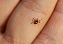 На Павлоградщине зафиксировали случай болезни Лайма