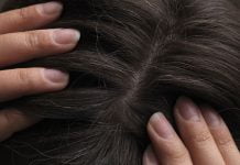 Педикулёз на Днепропетровщине находят даже в «благополучных» семьях