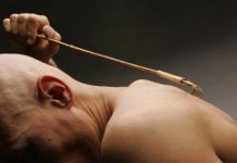 До 20 человек в Павлограде ежегодно заражаются чесоткой