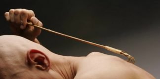 До 20 человек в Павлограде ежегодно заражаются чесоткой