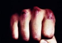 В Богуславе жестко избили пенсионеров. Одна из жертв скончалась