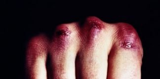 В Богуславе жестко избили пенсионеров. Одна из жертв скончалась