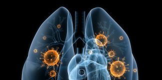 В Павлограде выявили туберкулёз у 8 шахтёров