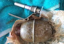 У военнослужащего нашли гранату, которую он якобы забыл выложить