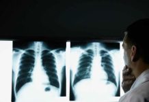 Жители Химзавода будут ездить за рентгеном и флюорографией в центр