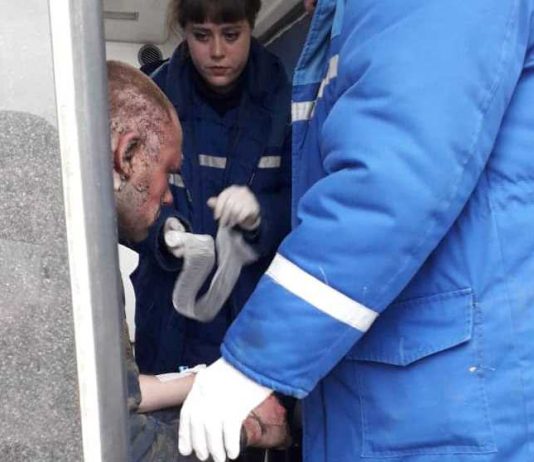 Хозяин дома пострадал из-за пожара в котельной (ФОТО)
