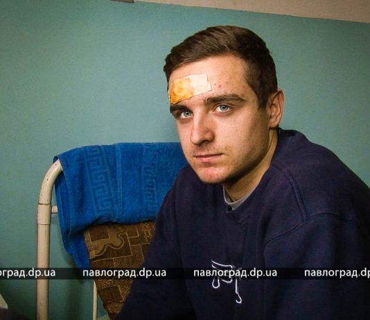 Павлоградец, у которого взорвался вейп, рассказал, как это было (ВИДЕО)