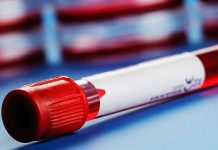 Медик: Павлоград — территория с высоким уровнем заболеваемости вирусными гепатитами