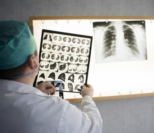 В Днепре прошел митинг против «переезда» тубдиспансеров