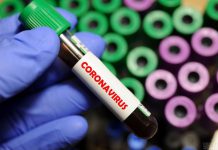 В Терновке и Павлоградском районе — новые случаи COVID-19