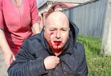 В Павлограде мужчину избили возле собственного дома (ФОТО и ВИДЕО)