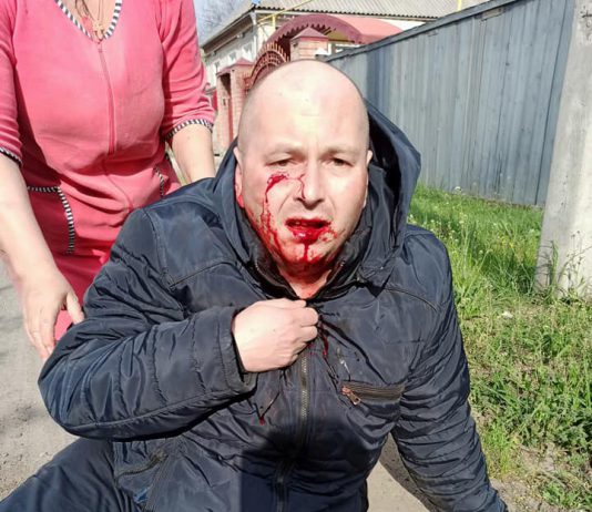В Павлограде мужчину избили возле собственного дома (ФОТО и ВИДЕО)