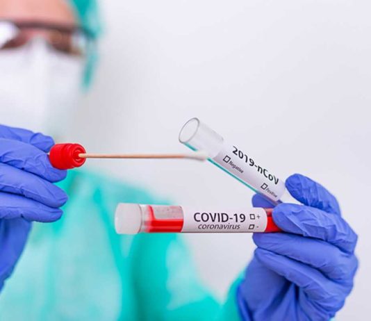 Сколько в Павлограде стоит тест на коронавирус и где можно сделать?