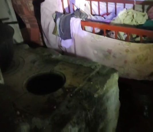 На Петропавловщине во время пожара младенец получил тяжелейшие ожоги