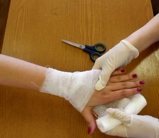 Из-за неразделенного имущества павлоградка облила сестру кипятком