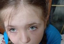 9-летняя павлоградка спасла летучего мышонка (ФОТО и ВИДЕО)