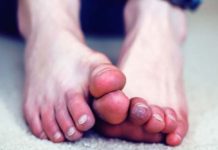 Чоловік відморозив ноги, рубаючи дрова