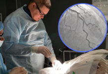 У Павлоградській лікарні розповіли як рятують людей з гострими інфарктами