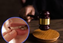 У Тернівці жінка вкусила знайому за губу: справа дішла до суду