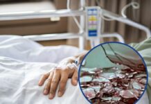 Вибух перевернув життя: після ракетного удару Світлана потрапила в реанімацію