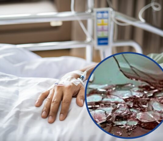 Вибух перевернув життя: після ракетного удару Світлана потрапила в реанімацію