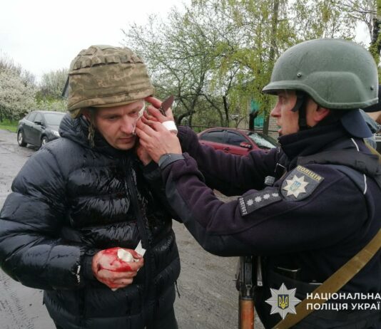 На Синельниківщині внаслідок вибуху гранати поранено п’ятьох поліцейських